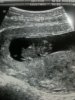 keri scan 9 weeks.jpg